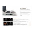 The Dolphi S2 black-and-white ultrasound diagnostic system includes a convex and vaginal sensor