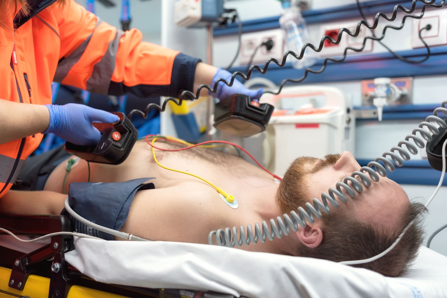 Defibrillator: what types there are and the principle of work